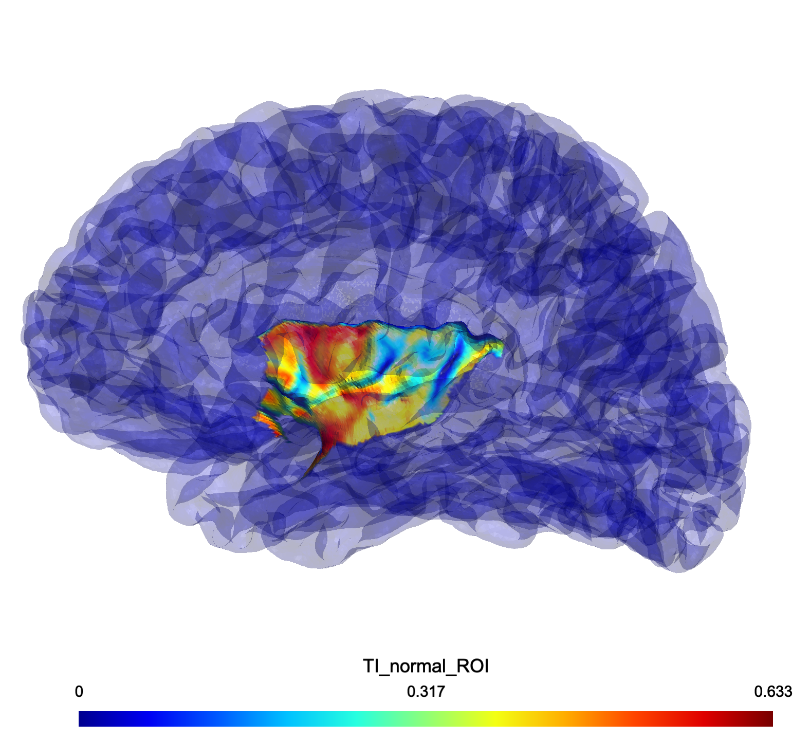 Normalized TI Field