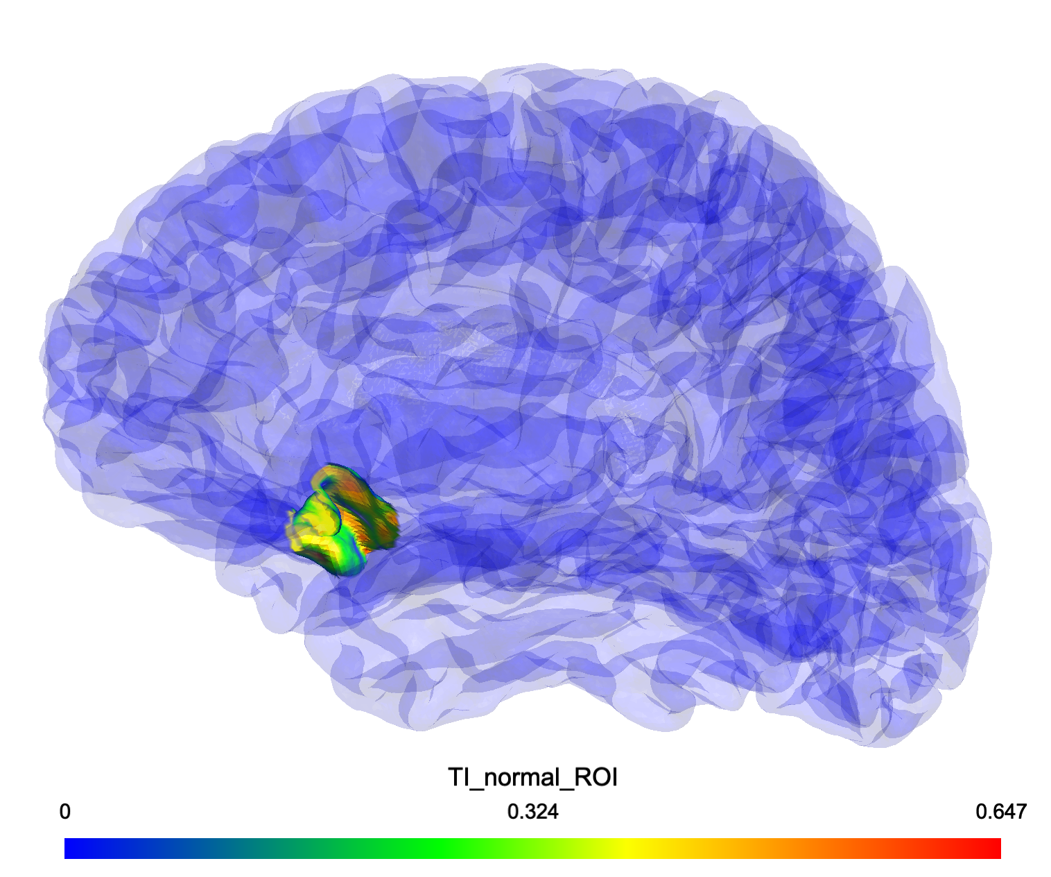 Spherical TI_normal Analysis