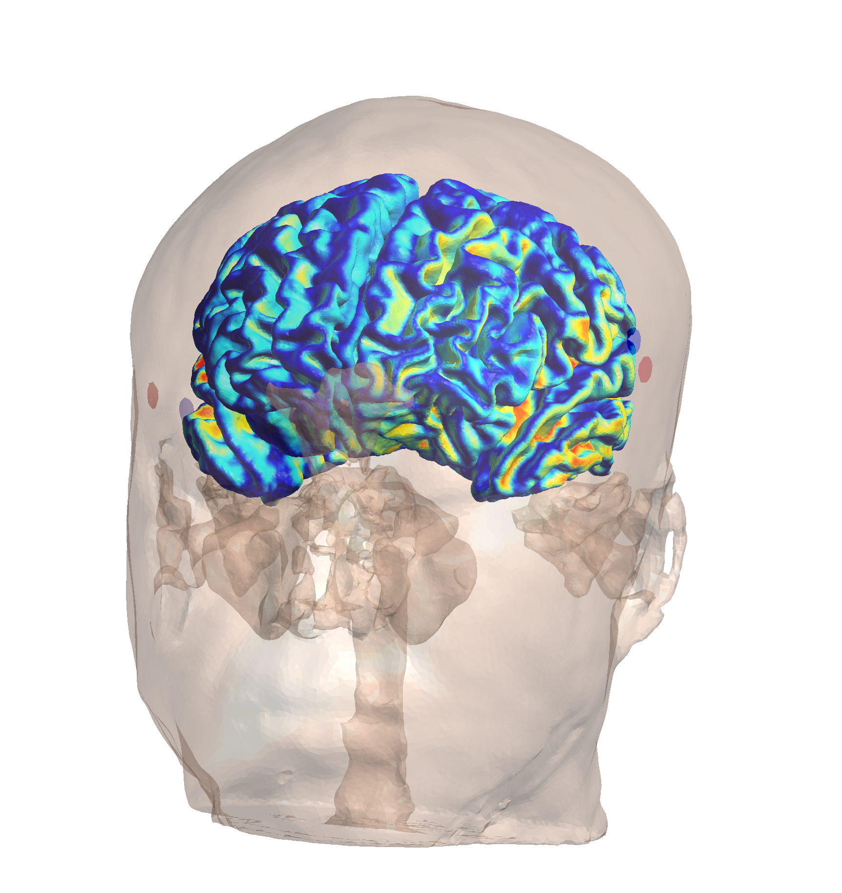 Normal Field Component