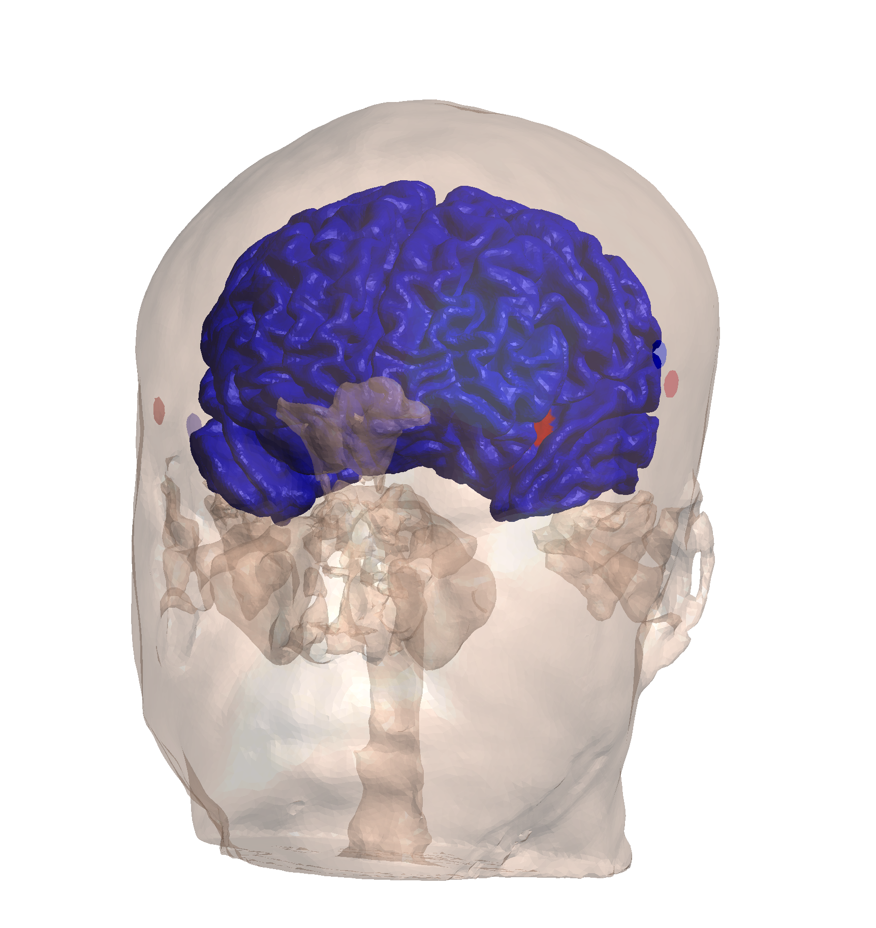 Normal ROI Component