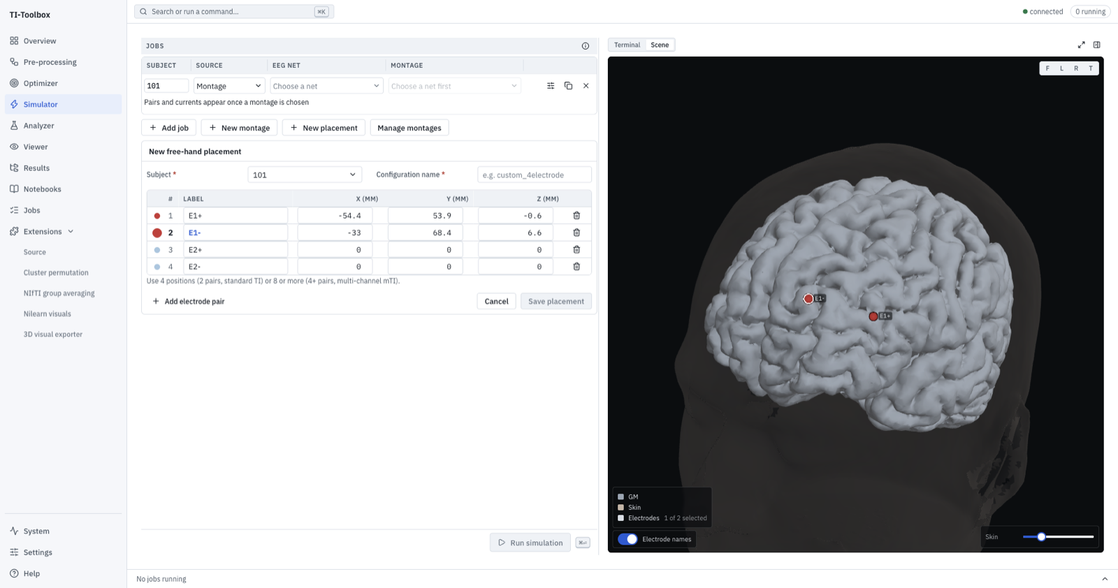 The free-hand placement editor for subject 101: E1+ and E1- placed on the head with their coordinates filled in the table