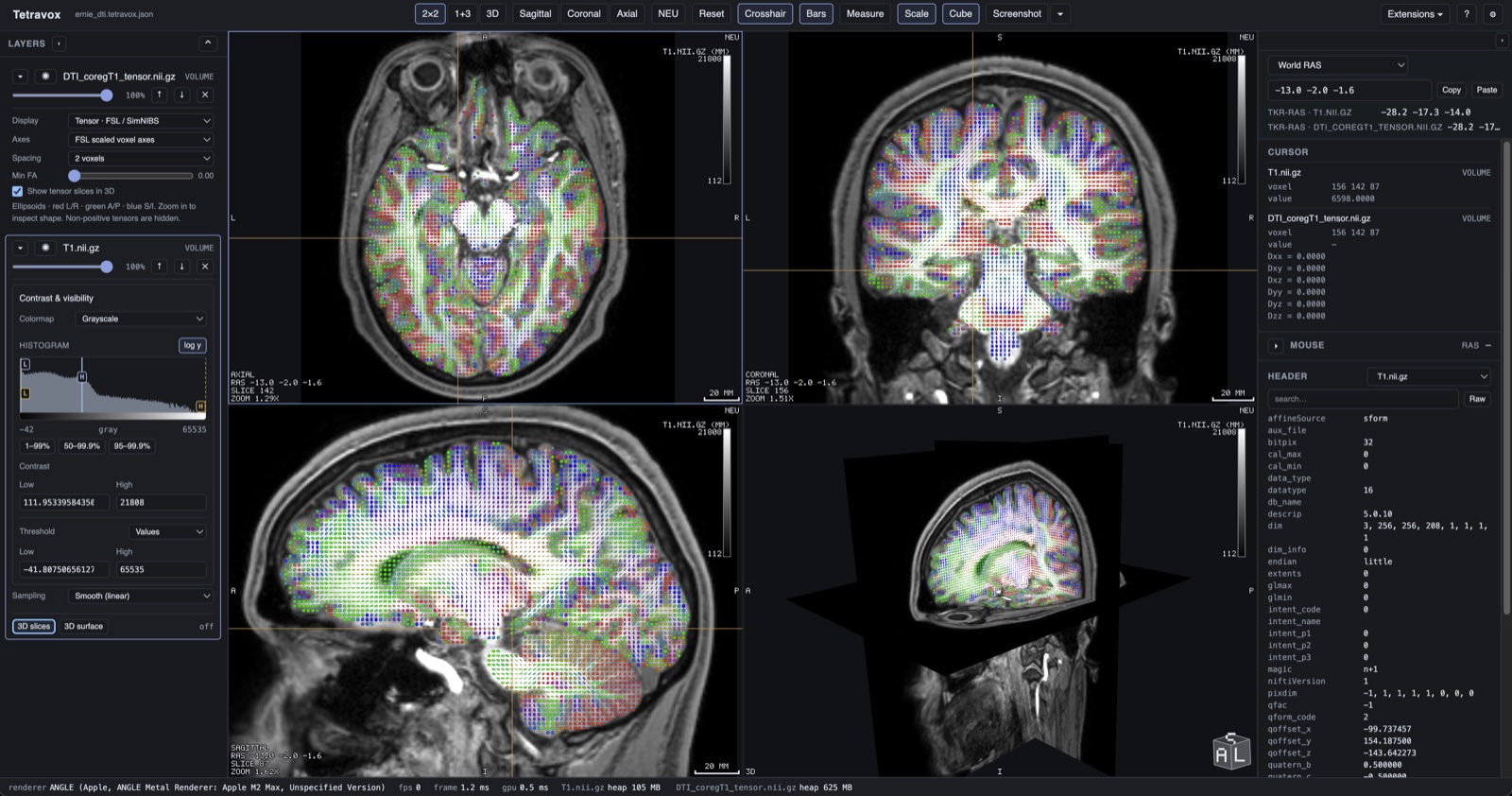 TetraVox showing diffusion tensors over a T1 in four views