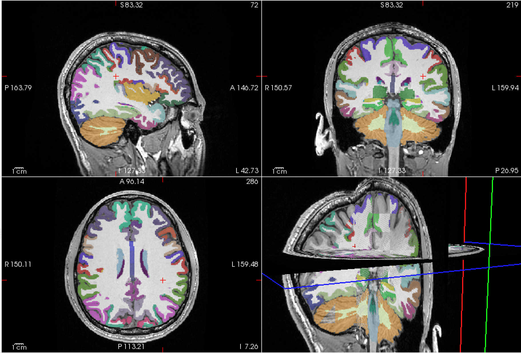 MRI Atlas Visualization