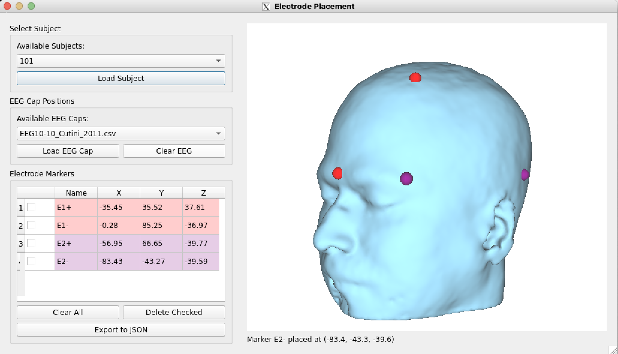 Freehand Electrode Placement