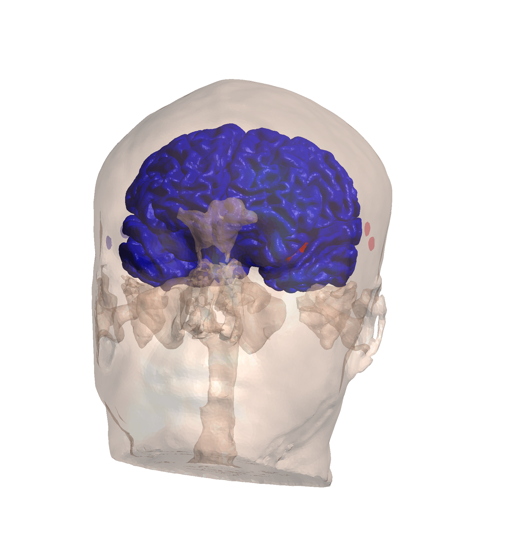 Maximum TI ROI Targeting