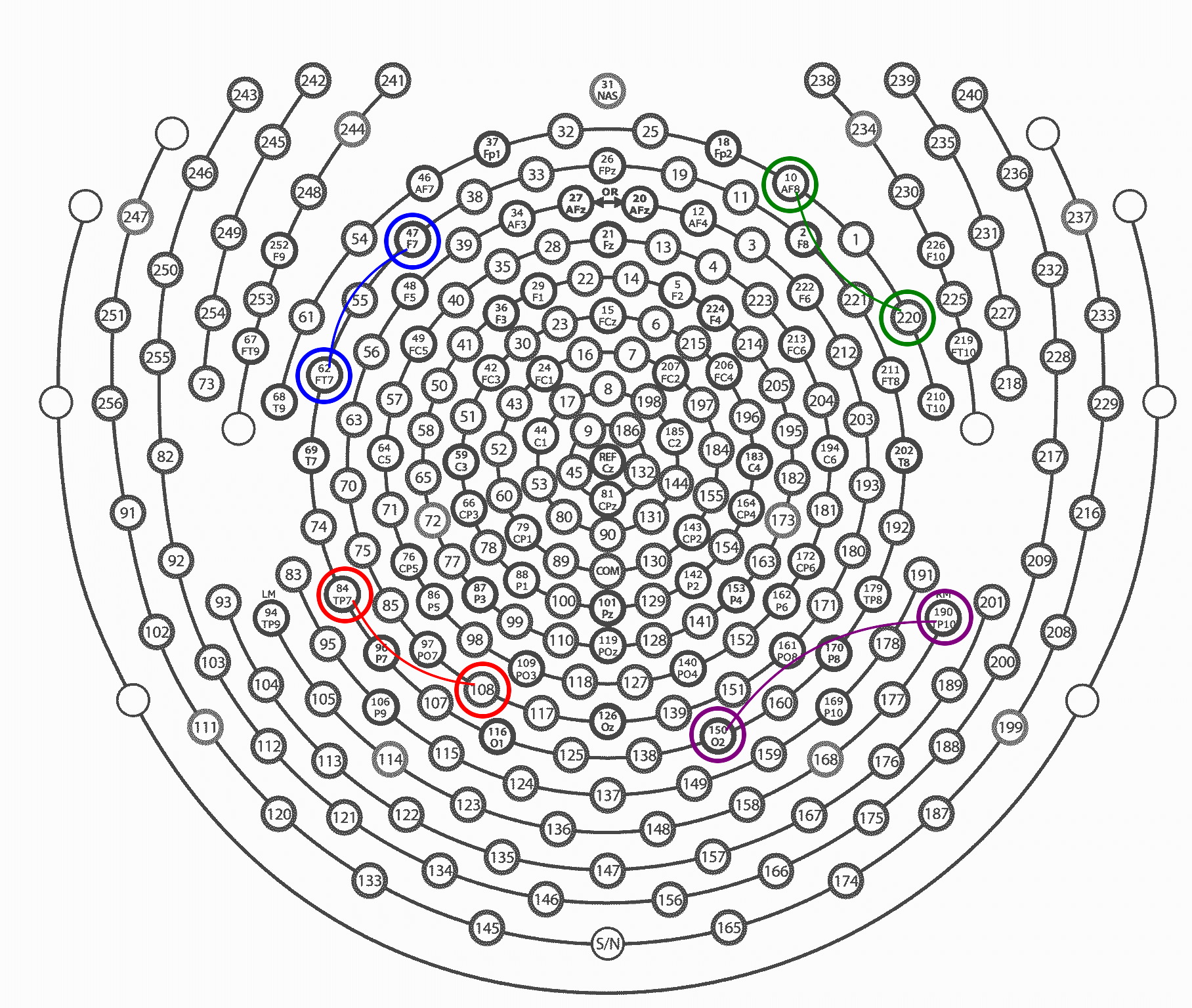 Multipolar Montage Example