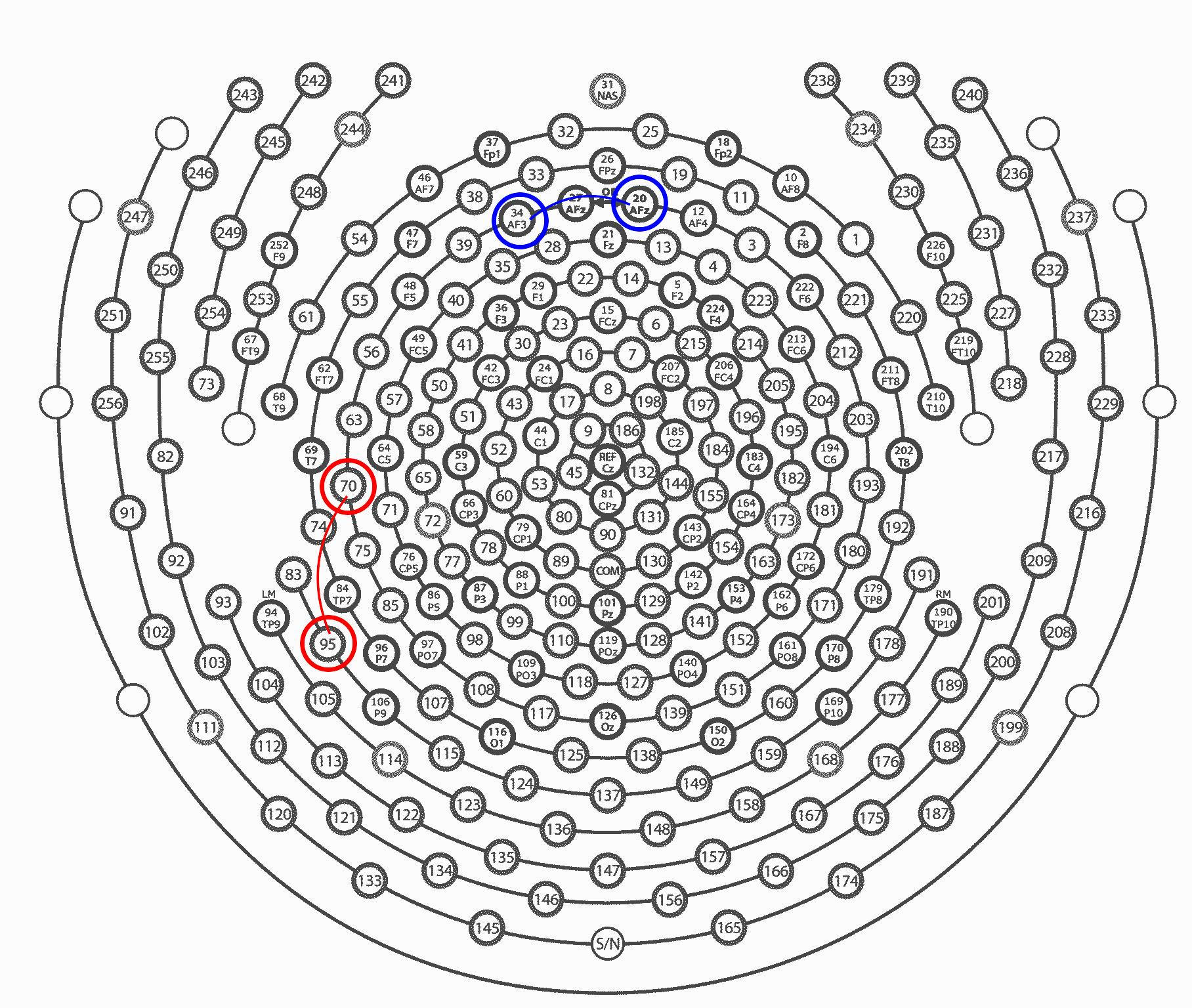 Unipolar Montage Example