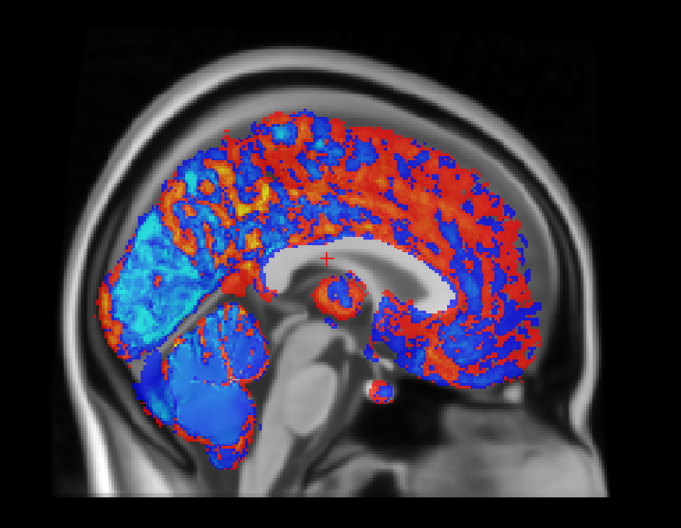 Group Difference Visualization