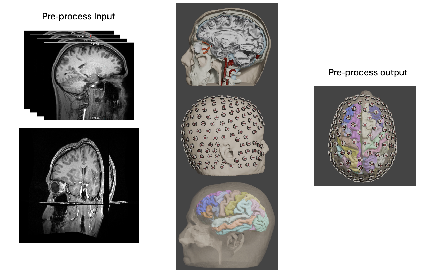 Pre-processing