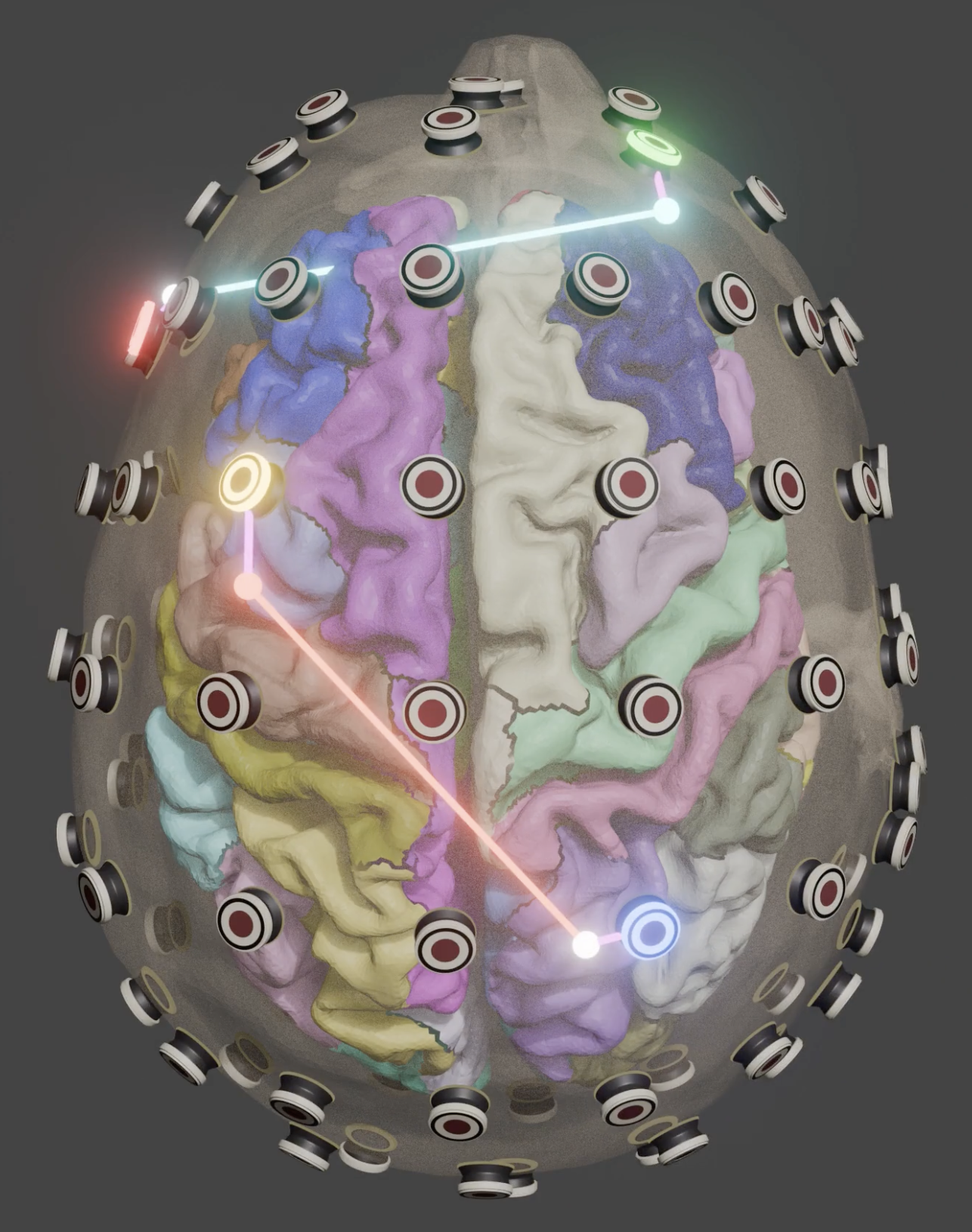 Electrode Mapping