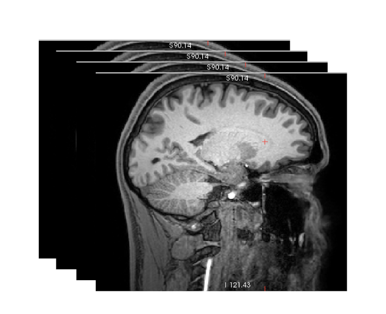DICOM Processing