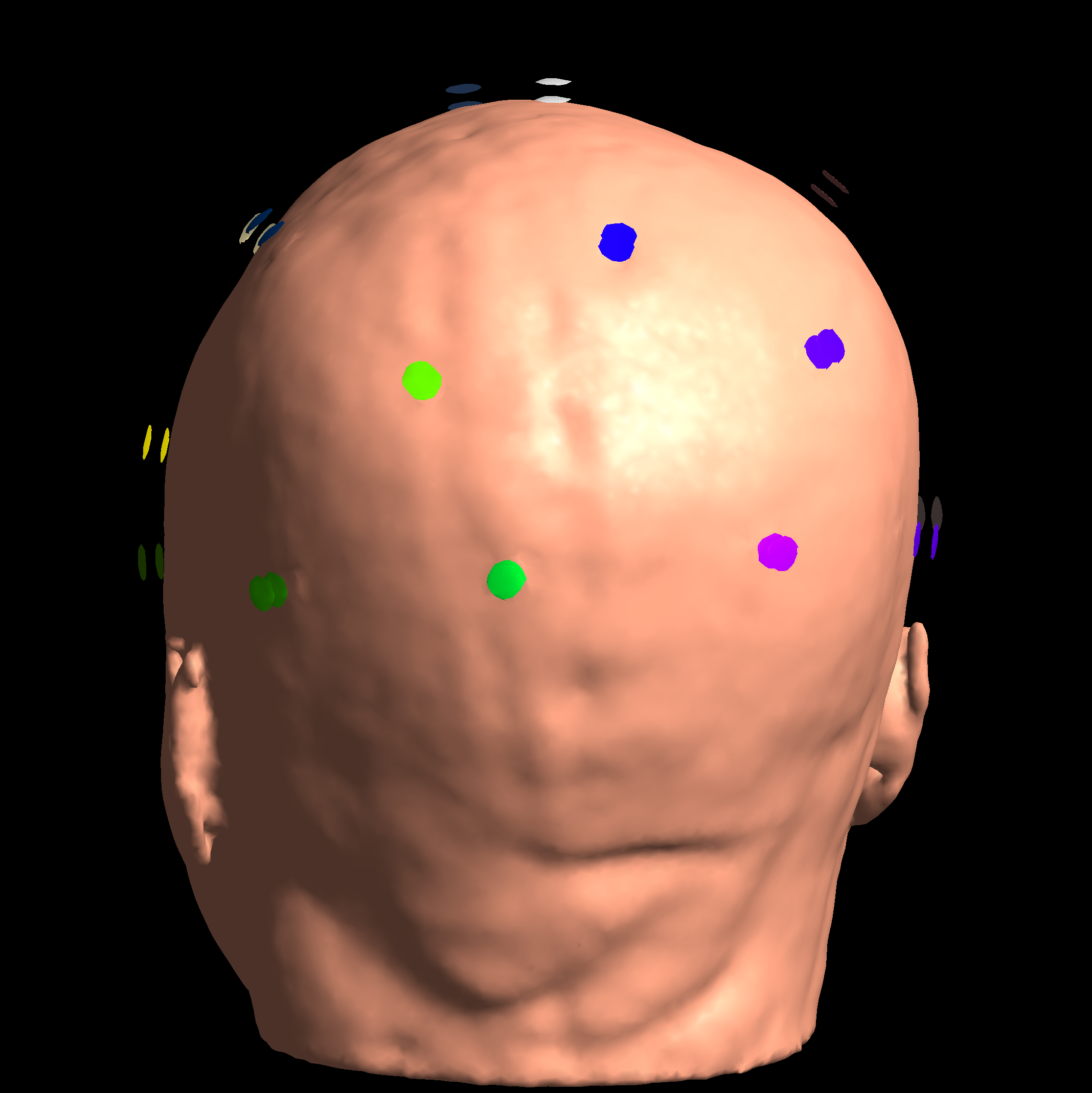EEG 10-20 Network