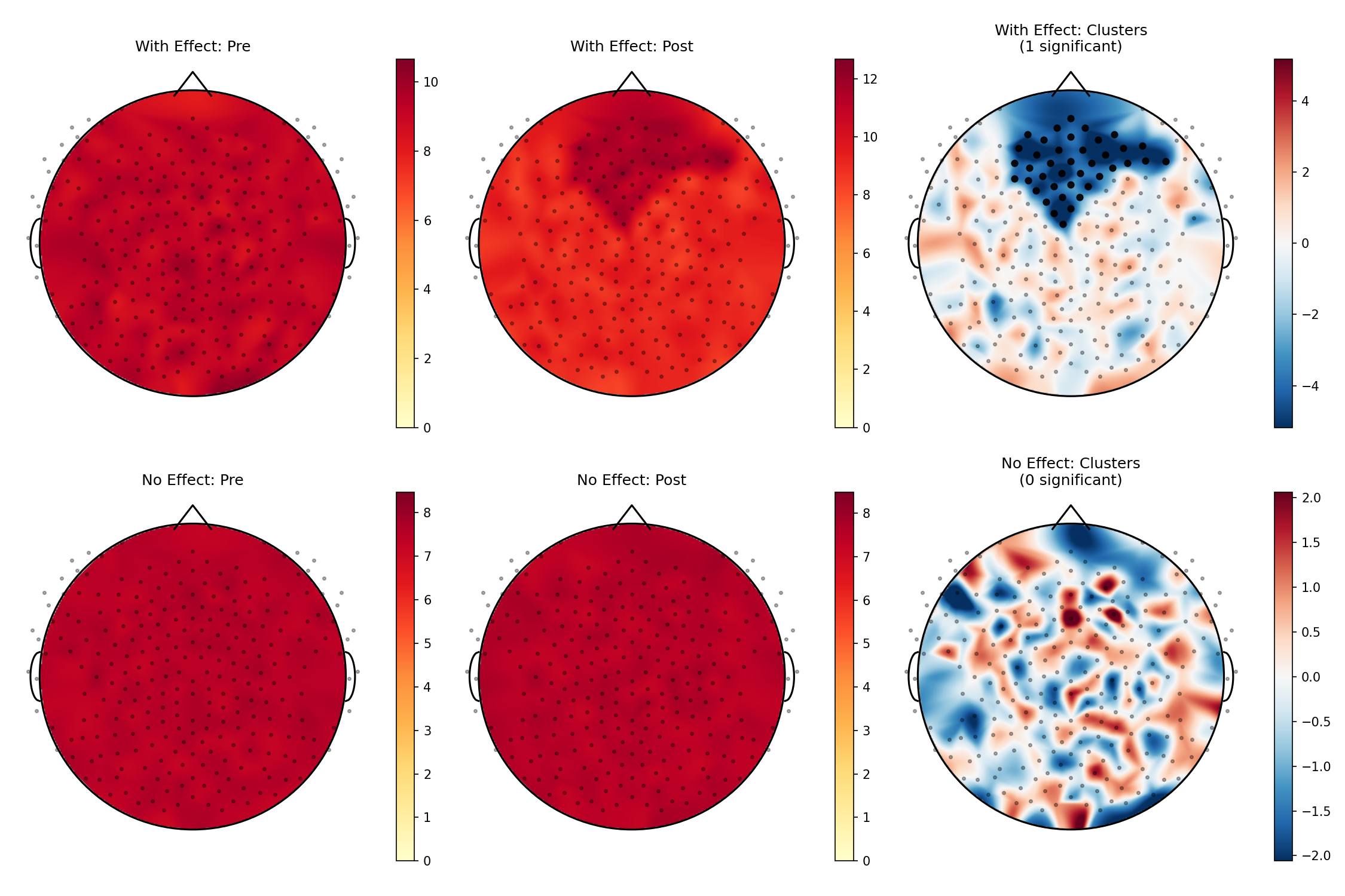 EEG Topographic Analysis Results