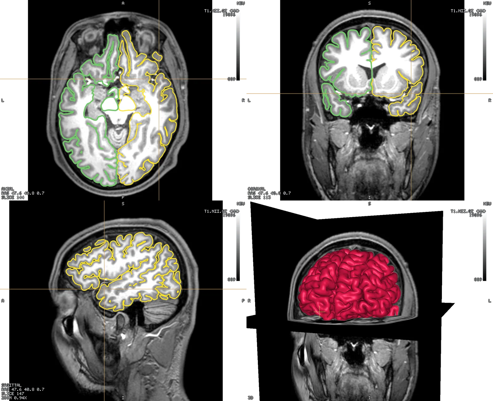 Both pial surfaces, each contour in its own colour