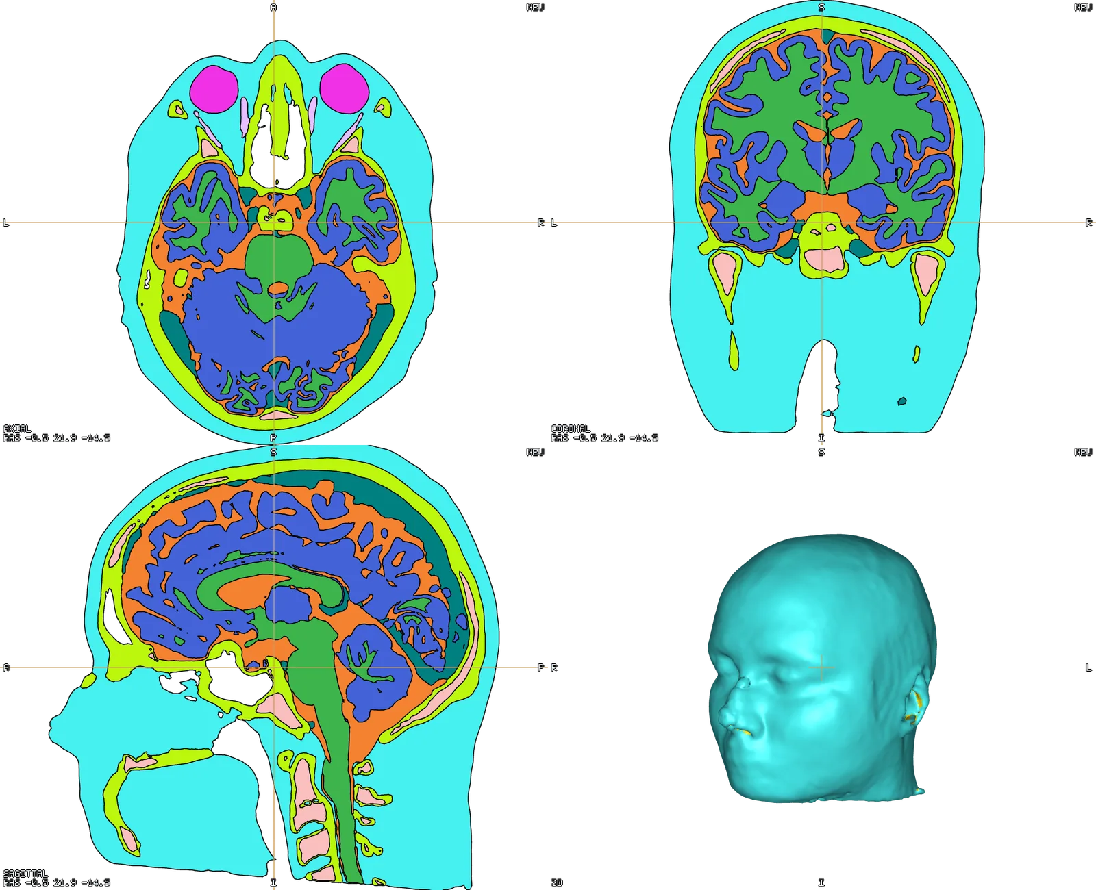 A head mesh: its tissue cross-section in the slice panes and the scalp surface in 3D