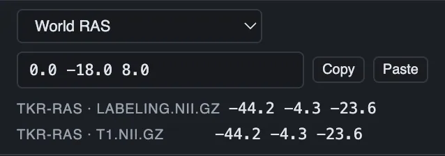 Coordinate read-out in four spaces at once
