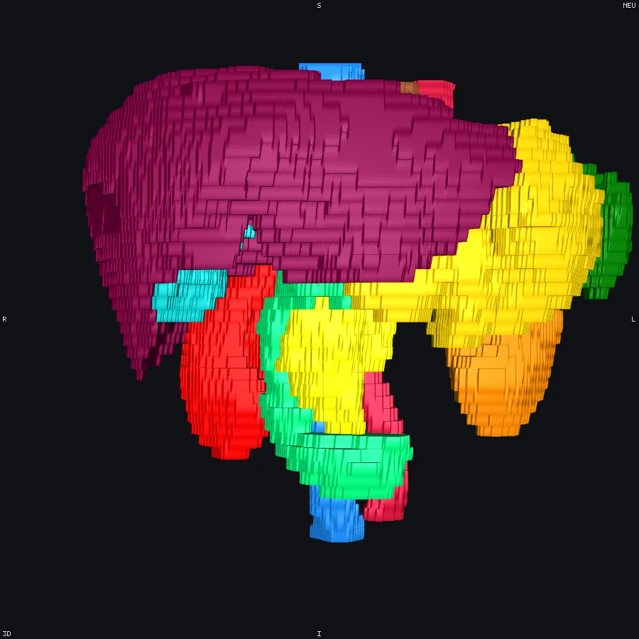 Isosurfaces, off the head