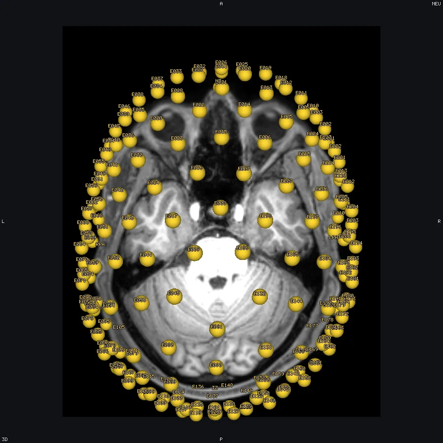 An EEG net as labelled points in 3D