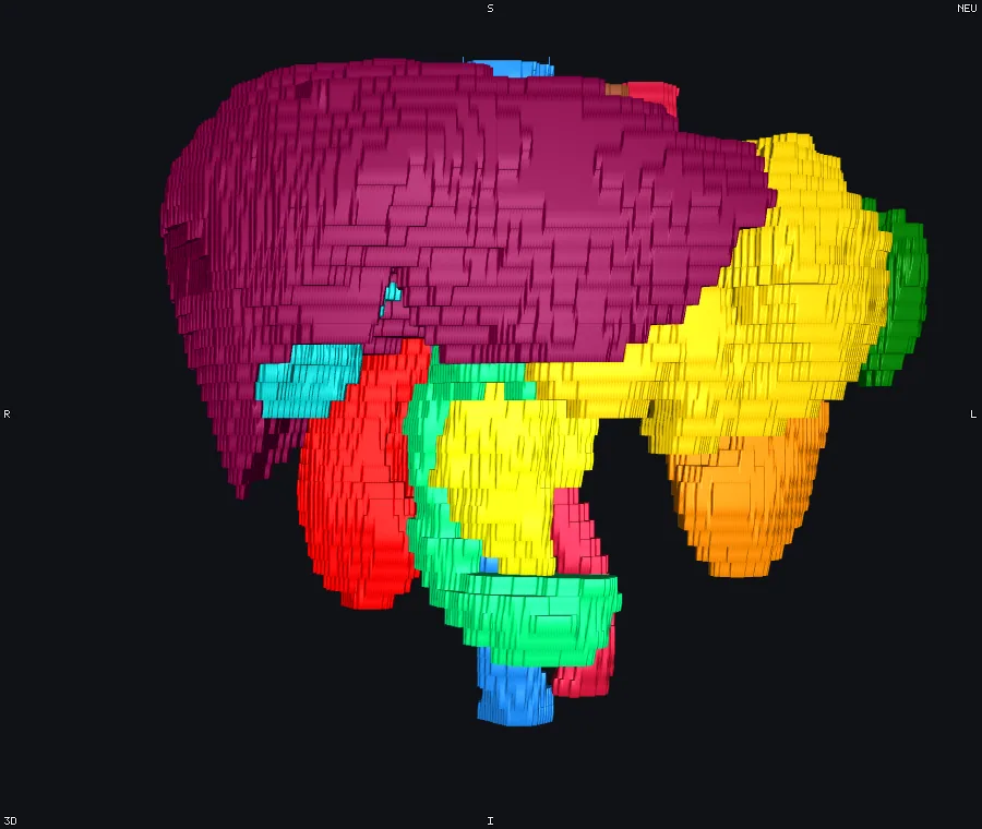 Abdominal organs as surfaces