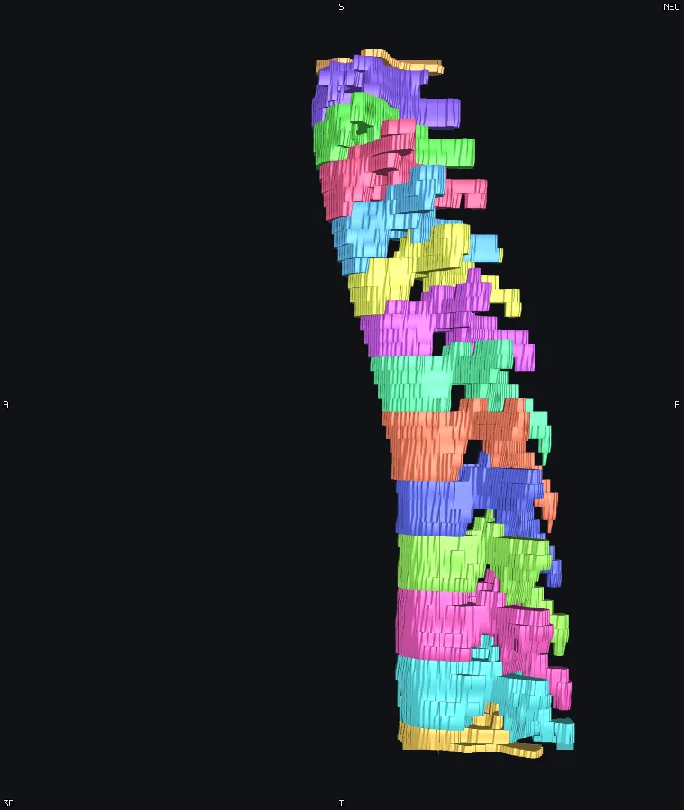 Vertebrae as surfaces