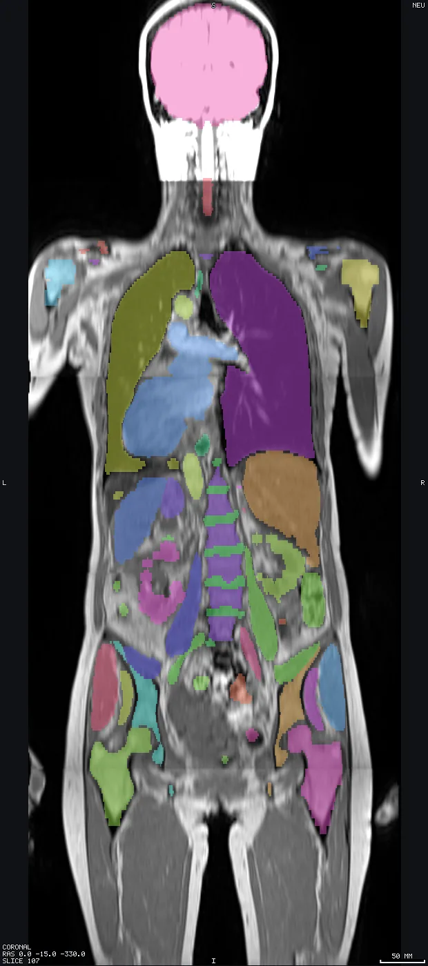 Whole-body MRI with 49 structures