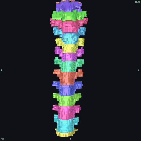 A turntable of per-vertebra isosurfaces from a labelled spine CT