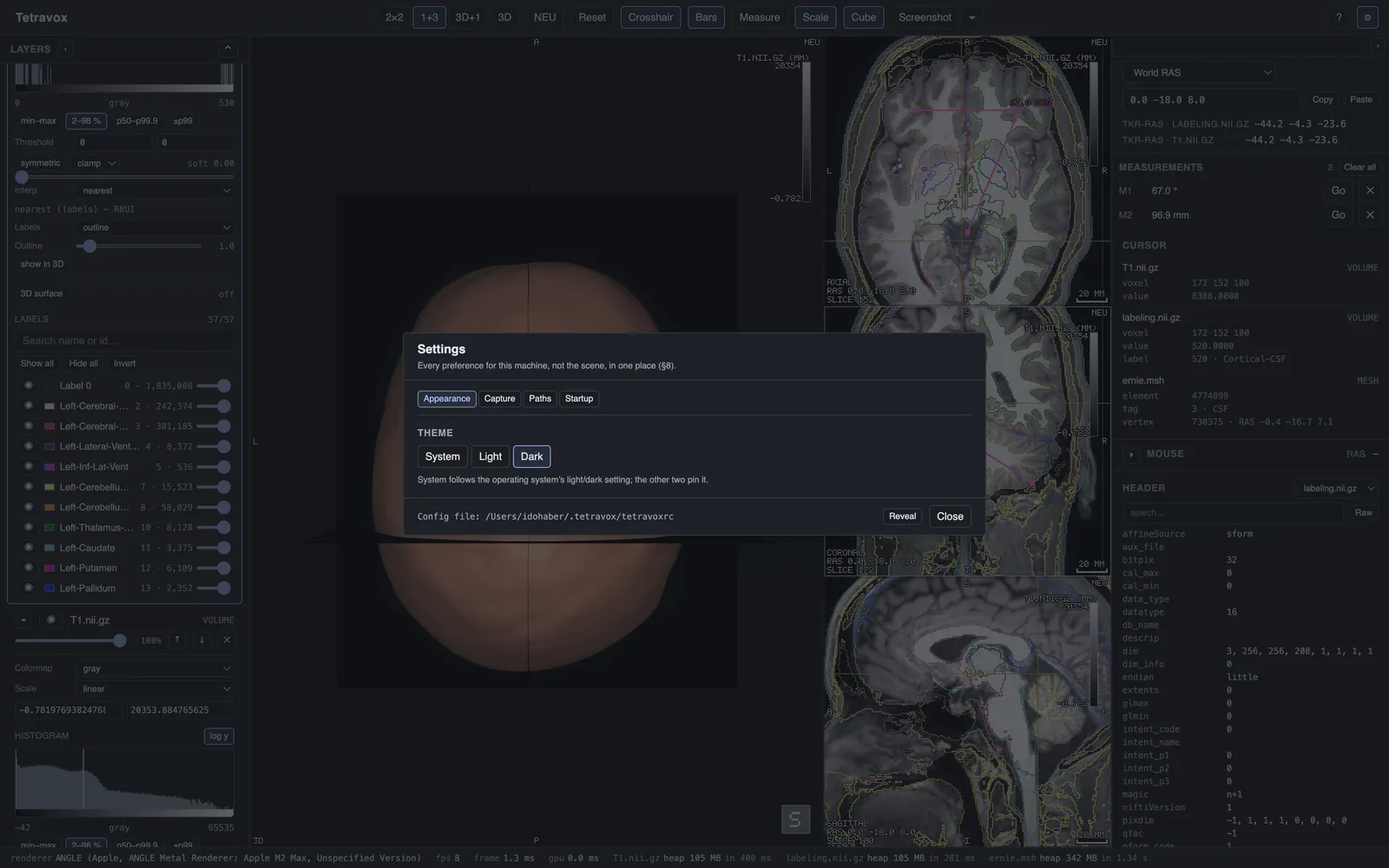 The Settings dialog